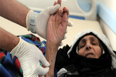 حالات الاصابة بالكوليرا في اليمن تجاوزت نصف مليون