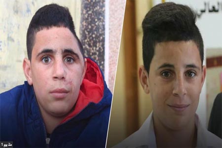 الطفل محمد التميمي قبل وبعد اصابته برصاص الاحتلال
