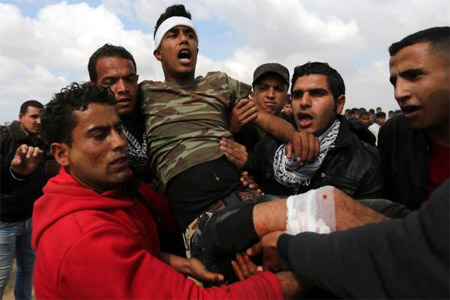 أطباء: معظم المصابين في المسيرات سيعانون من إعاقة دائمة