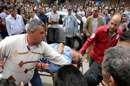 A victim is seen on a stretcher after a bomb went off at a Coptic church in Tanta, Egypt, April 9, 2017