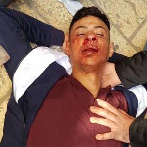 إصابة مقدسي إثر اعتداء مستوطنين عليه قرب المسجد الأقصى